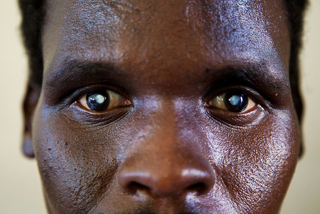 A blind man in Al Fasher, Sudan. Credit: UN Photo:Albert Gonzelez Farran